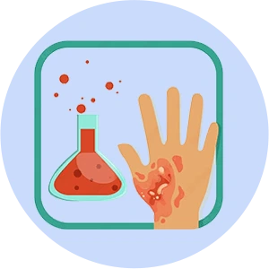 Gangrene Treatment In Hyderabad