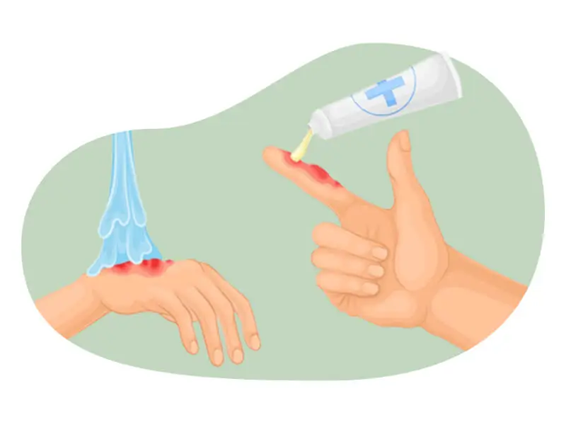 Gangrene Treatment In Hyderabad