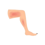 Redness and Swelling